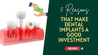 5 Reasons that Make Dental Implants a Good Investment | Dental House MI