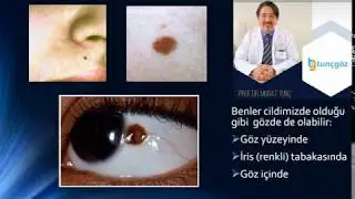 Gözde ben olur mu?