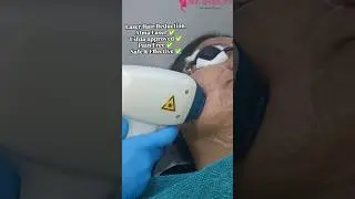 laser Hair Reduction Alma Advanced laser.#almalasers #laser #skinsmileclinic
