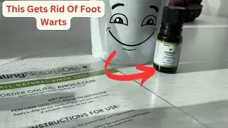 H Warts Formula | How To Use To Cure Plantar Warts