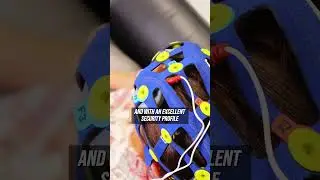 Transcranial Direct Current Stimulation. Milton Medeiros - MD.