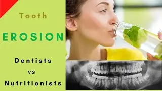 How Lemon water can damage your tooth enamel. Nutritionists vs Dentists
