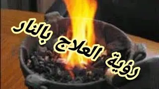 Interpretation of seeing fire therapy