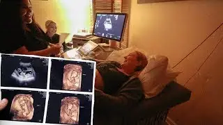 Seeing The Twins in 3D Ultrasound at 12 Weeks!!!