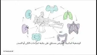 أسس التخدير || العملي: المحاضرة الرابعة الوضعيات الجراحية surgical positions 