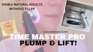Time Master Pro - Before After - Cheek Plumping Results!