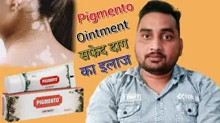Pigmento Ointment Uses in hindi..||सफेद दाग का इलाज..[Rahul pharma Clinic]