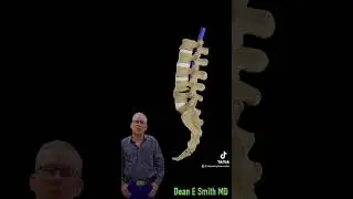 Minimally, invasive surgery, lumbar spinal stenosis