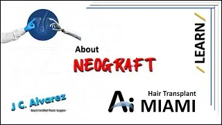NeoGraft: A Revolution in Hair Transplant Technology