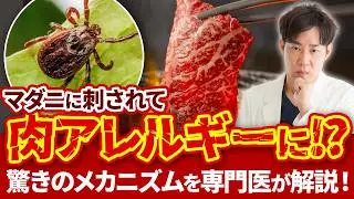 マダニに刺されると牛肉アレルギーに!? 『&alpha;-Gal症候群』を徹底解説！