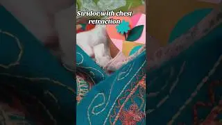 Abnormal respiratory Sound-Stridor real sound with chest retraction #shorts #medicine #doctor