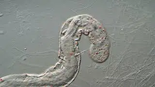 Microscopic World, Aeolosoma hemprichi