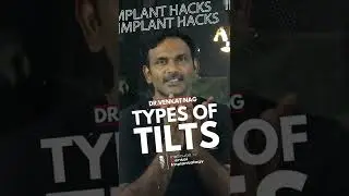 Types of Tilts | Implant Hacks by Dr. Venkat Nag, MDS