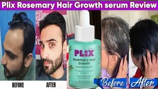 Plix Rosemary Hair Growth serum Review  | it's really works?
