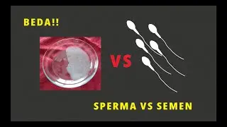PERBEDAAN SPERMA DENGAN SEMEN?