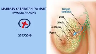 MATIBABU YA SARATANI  YA SARATANI YA MATITI KWA MWANAMKE  - REBECCA GILBERT AFISA MUUGUZI  (SEHA)