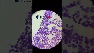 Выпот с лимфоцитарным компонентом из грудной полости кошки #лабораторнаядиагностика