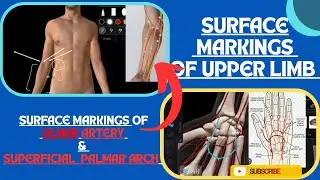 Surface Marking of Ulnar Artery & Superficial Palmar Arch | Surface Markings of Upper Limb