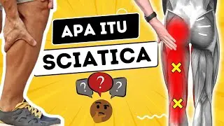 KENALI SAKIT- SCATICA - AL-AMIN TERAPI SARAF 01150404441