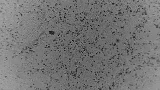 Warnings issued amid Coronavirus outbreak
