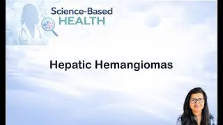 Understanding Liver Hemangiomas