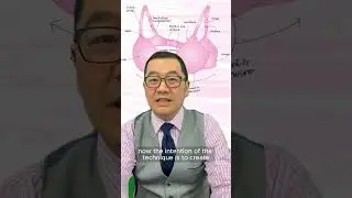 The Internal Bra Technique