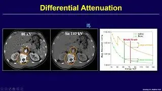 Dual Energy CT: Musculoskeletal Applications by Jan Fritz, M.D., P.D., D.A.R.B.