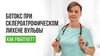 Ботулотоксин для лечения склероатрофического лихена вульвы.