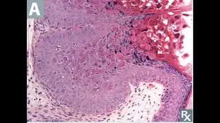 Poxvirus