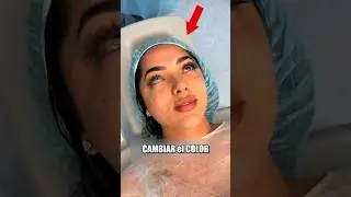 CL&Iacute;NICA hace CAMBIO de COLOR de OJOS 😨
