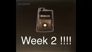 Medtronic MiniMed 770G Week 2 Update