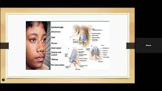 Surgical anatomy of Nose & Paranasal sinuses - Dr Ankit Mahuvakar