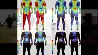 Personalized Prosthetics & Orthotics | Scott Summit | Exponential Medicine 2015