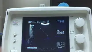 Medison SA-600 part 1