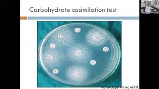 IDENTIFICATION OF CANDIDA SPP