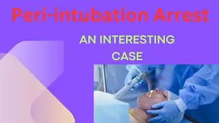 Peri-intubation Cardiac Arrest in a Septic Patient