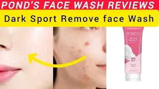 Pond White Beauty Face Wash|Pond's Face Wash Review|Ponds Face Wash Acne Clear|Skin White Face Wash