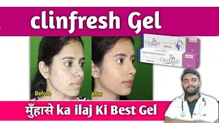 Обзор геля Clinfresh | Гель Clinfresh | Гель Clinfresh от прыщей
