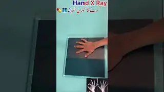 Hand XRay positioning video🩻💊 #drnakash2001 #drnakashvlogs