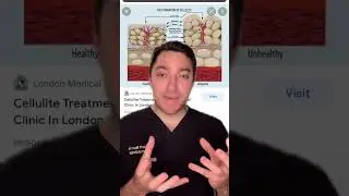 NEW treatment for cellulite Collagenase Injections - Unconventional Cosmetics - TikTok SkinDoc