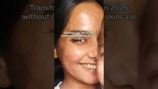 Find your root cause and watch things finally change! #acne #hormonalacne #acneproneskin
