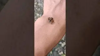 Bee sting 🐝 each other #shorts #video #beesting