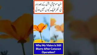 Cataract Surgery ke baad nazar dhundli kyun hai