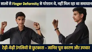 उंगली के टेढ़ेपन से परेशान? जानिए कारण और सटीक समाधान | Finger Deformity Treatment