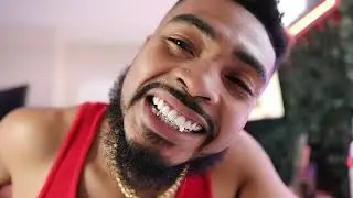 Custom Gold Grillz Review | Not What You Expect!