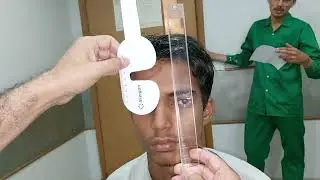 Cover uncover, alternating cover test & measuring Squint with prism bar