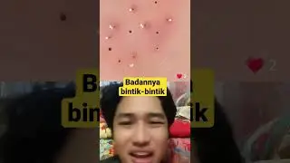 BADAN BINTIK-BINTIK #viral