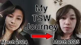 TSW Ruined My Life - My Topical Steroid Withdrawal Story