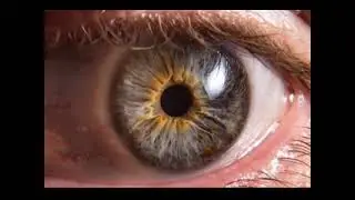 Retinal Regeneration Via Prox-1 Inhibition