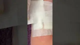Ameliyat sonrası pansuman